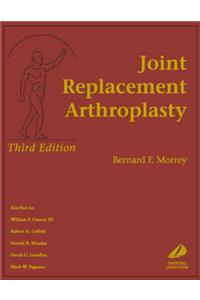 Joint Replacement Arthroplasty