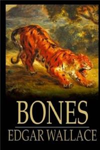 Bones