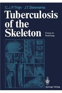 Tuberculosis of the Skeleton