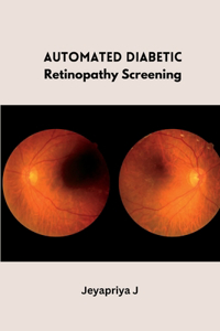 Automated Diabetic Retinopathy Screening