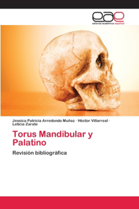 Torus Mandibular y Palatino