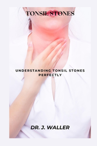 Tonsil Stones: Understanding Tonsil Stones Perfectly