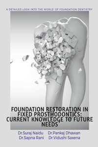 Foundation Restoration in Fixed Prosthodontics