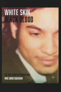 White Skin Black Blood