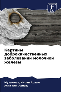 Картины доброкачественных заболеваний м&