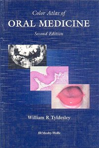 Color Atlas of Oral Medicine