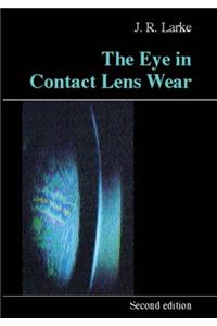 Eye in Contact Lens Wear