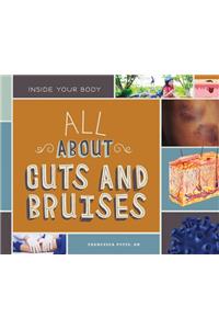 All about Cuts and Bruises