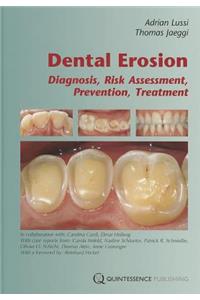 Dental Erosion
