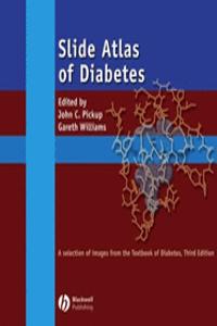 Slide Atlas of Diabetes, CD-ROM: A Selection of Images from the Textbook of Diabetes