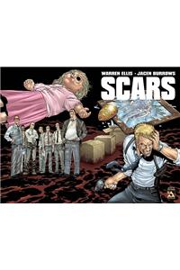 Scars