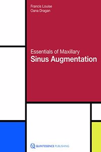 Essentials of Maxillary Sinus Augmentation