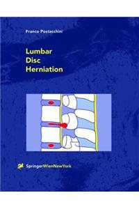 Lumbar Disc Herniation