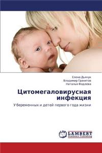 Tsitomegalovirusnaya Infektsiya