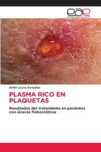 Plasma Rico En Plaquetas