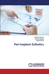 Peri-implant Esthetics