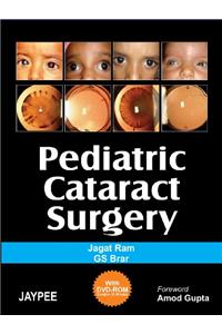 Pediatric Cataract Surgery (with DVD-ROM)