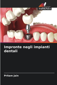 Impronte negli impianti dentali