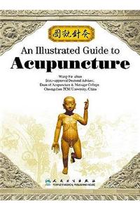 Illustrated Guide to Acupuncture