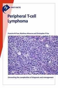 Fast Facts: Peripheral T-Cell Lymphoma: Unravelling the