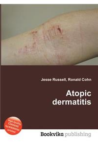 Atopic Dermatitis