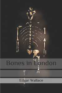 Bones in London