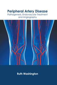 Peripheral Artery Disease: Pathogenesis, Endovascular Treatment and Angiography