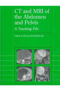 CT and MRI of the Abdomen and Pelvis: A Teaching File (Radiology Teaching File Series)