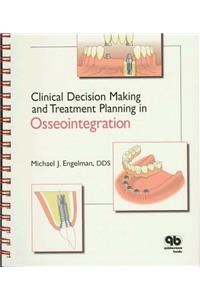 Clinical Decision Making and Treatment Planning in Osseointegration