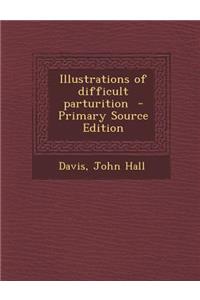 Illustrations of Difficult Parturition