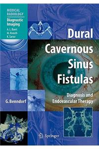 Dural Cavernous Sinus Fistulas