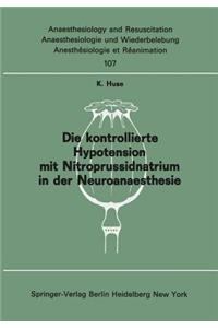 Die Kontrollierte Hypotension Mit Nitroprussidnatrium in Der Neuroanaesthesie