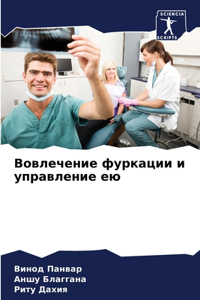 Вовлечение фуркации и управление ею