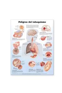 Dangers of Smoking Anatomical Chart in Spanish (Peligros del tabaquismo)