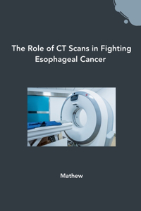 Role of CT Scans in Fighting Esophageal Cancer