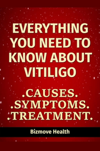 Everything you need to know about Vitiligo