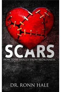 Scars