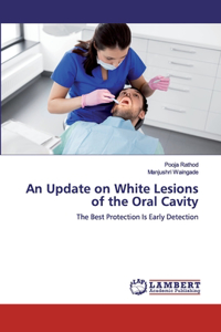 Update on White Lesions of the Oral Cavity