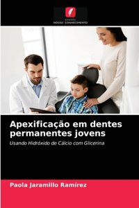 Apexificação em dentes permanentes jovens