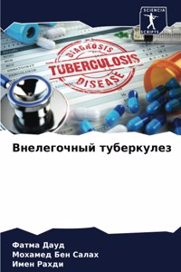 Внелегочный туберкулез