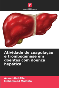 Atividade de coagulação e trombogénese em doentes com doença hepática