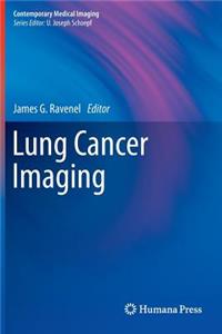 Lung Cancer Imaging