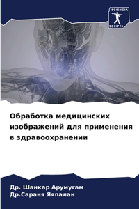 Обработка медицинских изображений для п