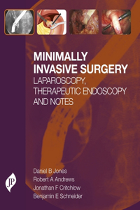 Minimally Invasive Surgery