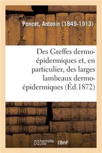 Des Greffes Dermo-Épidermiques Et, En Particulier, Des Larges Lambeaux Dermo-Épidermiques