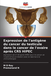 Expression de l'antigène du cancer du testicule dans le cancer de l'ovaire après CRS HIPEC