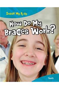 How Do My Braces Work?