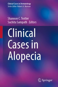 Clinical Cases in Alopecia