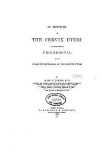 On amputation of the cervix uteri