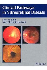 Clinical Pathways in Vitreoretinal Disease